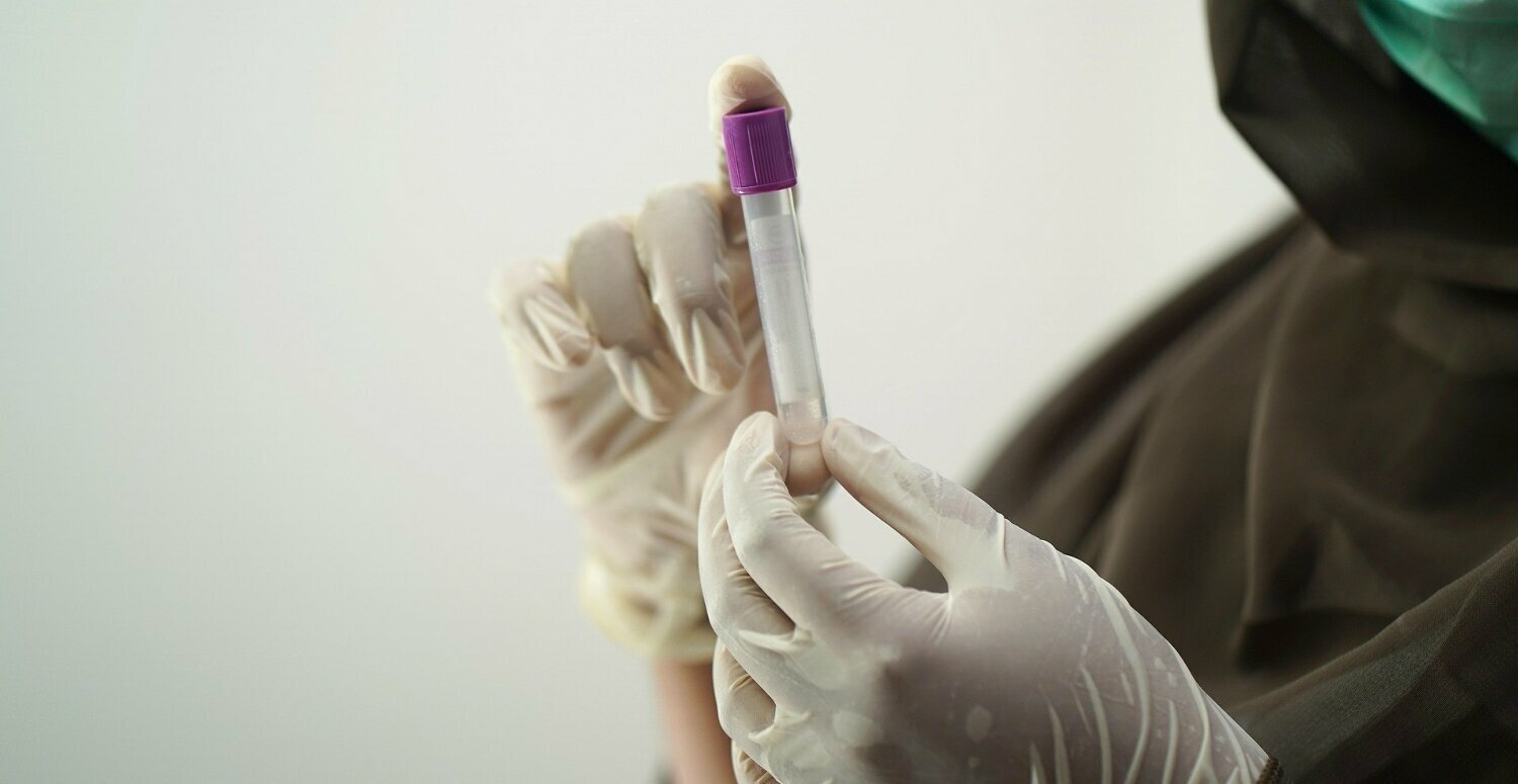 No momento, você está visualizando TST condena empresa por exigir teste de HIV em contratação
